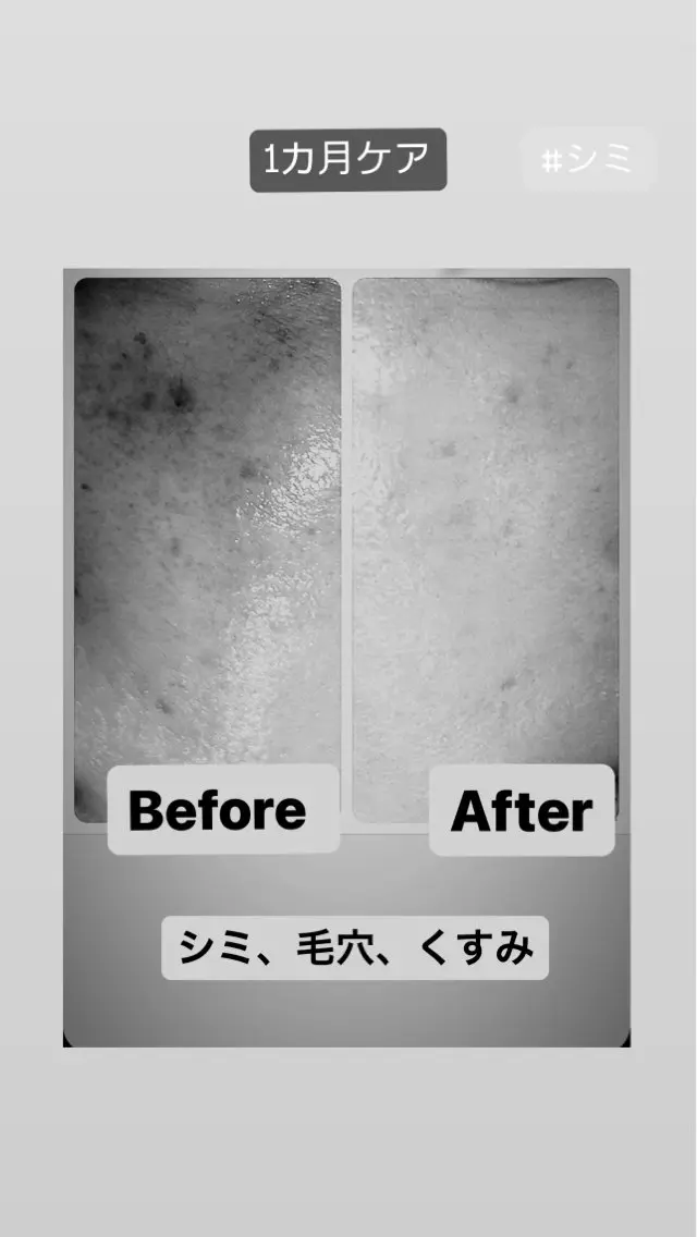 🅖🅤🅩🅔🅛 salonのエステ・リラクイメージ