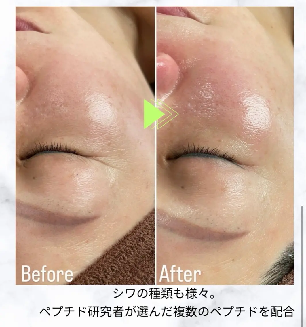 体感した事のないツヤ肌、本気で肌を育てたい方への写真