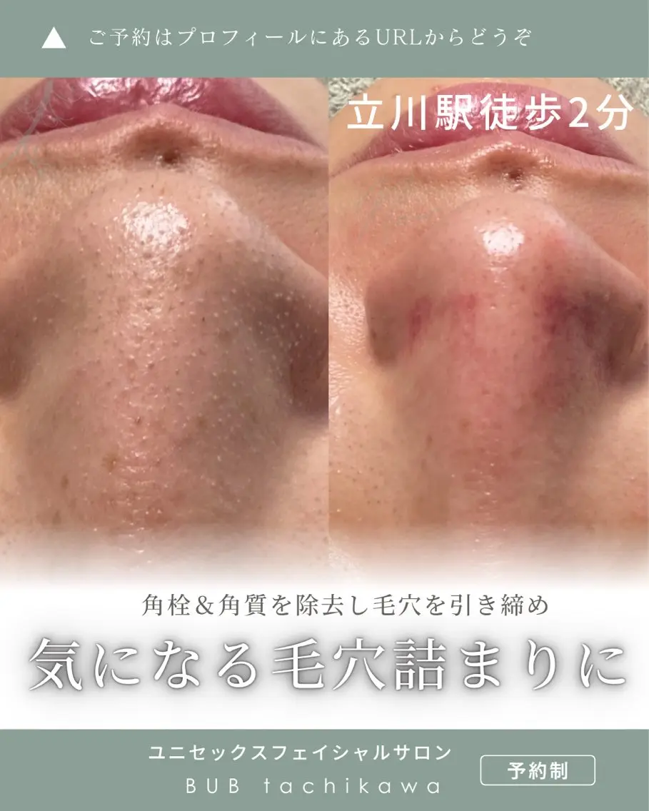 メンズ エステ 【BUB立川】 ゆかのエステ・リラクイメージ