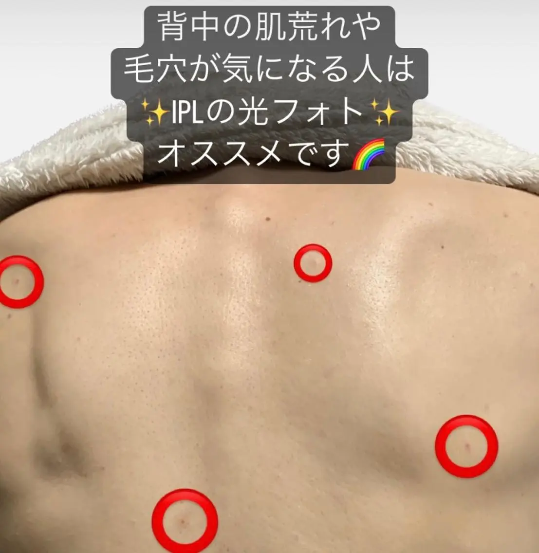 脱毛SALON RaYNiCKのエステ・リラクイメージ