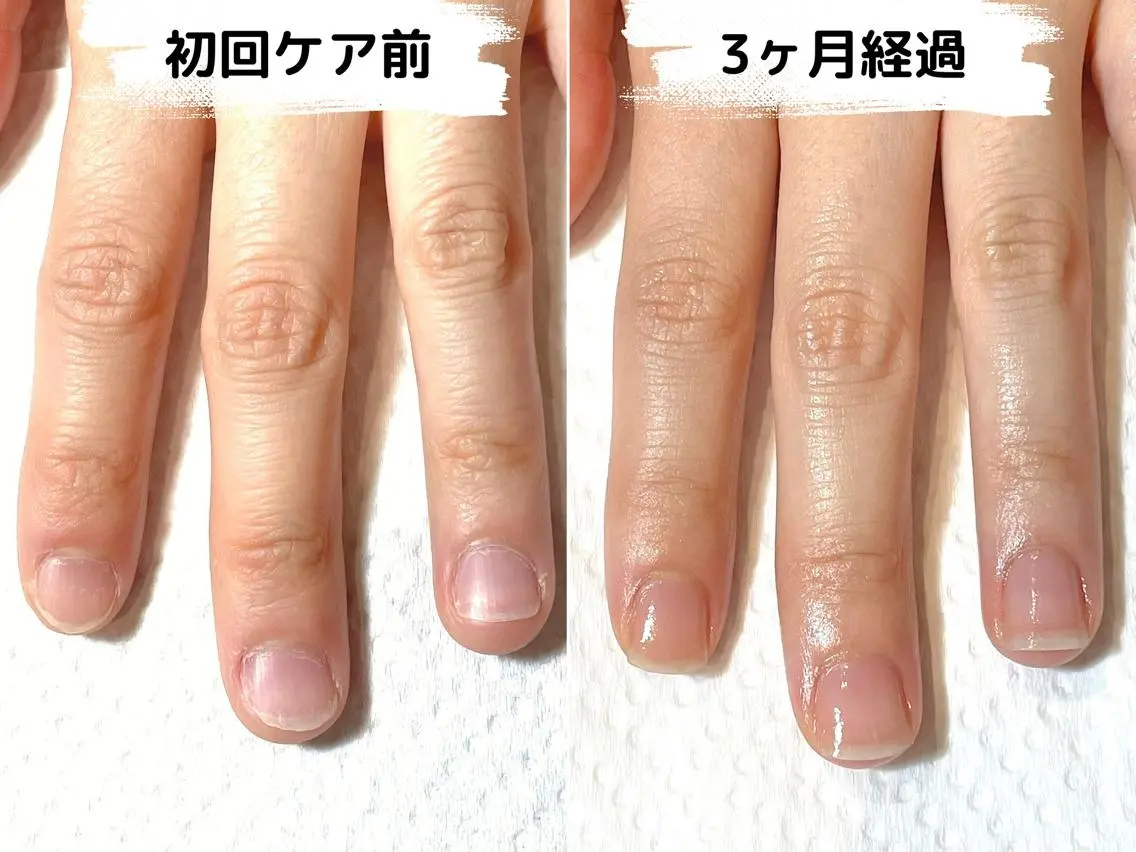 ネイル ハンドケア 自爪育成専門店 Kapilinaのネイルデザイン