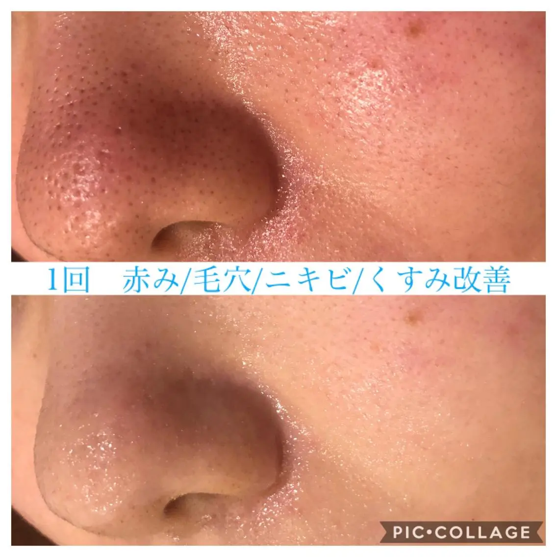 ロング カラー パーマ ヘアアレンジ メンズ キッズ ネイル マツエク・マツパ エステ リラク EnsorClair 代表 野口真央のエステ・リラクイメージ
