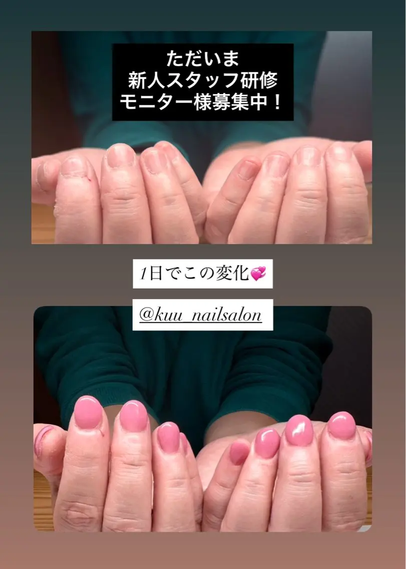 【新規様限定】ハンド深爪矯正/オシャレを楽しみながら深爪矯正​〜​ワンカラー仕上げでお爪の長さ出しの写真