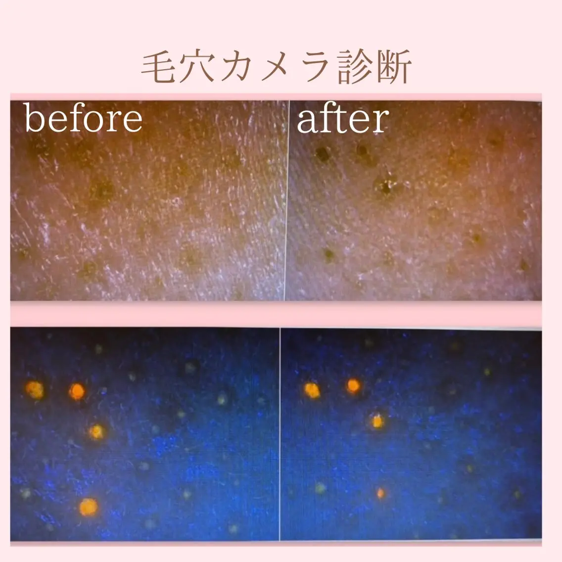 エステ グラサヴォーグ 堺なかもず店のエステ・リラクイメージ