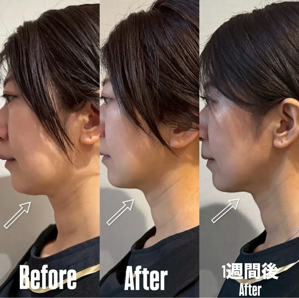 六本木脱毛andS Saoriのエステ・リラクイメージ
