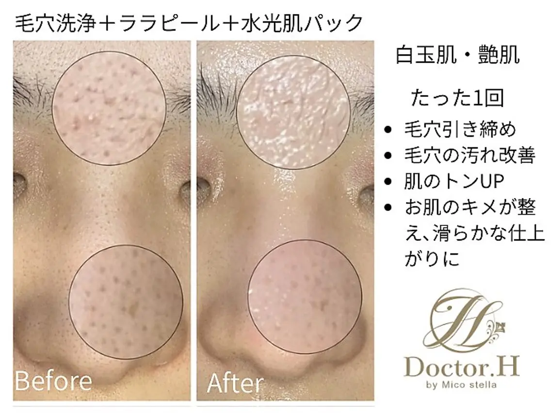 Doctor.H ララピール・小顔矯正のエステ・リラクイメージ