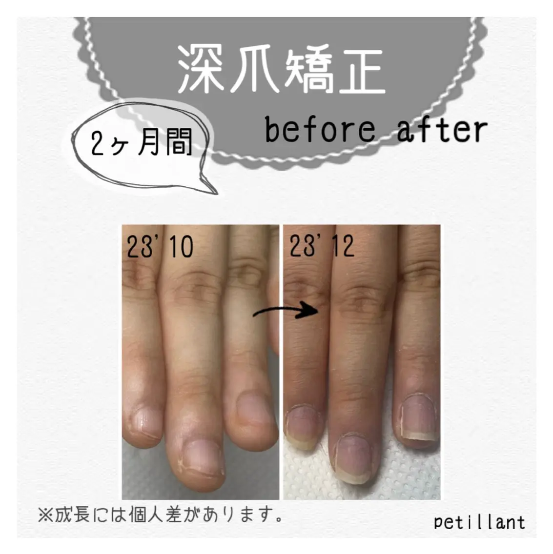 ネイル ジェルネイル nail salon petillantのネイルデザイン