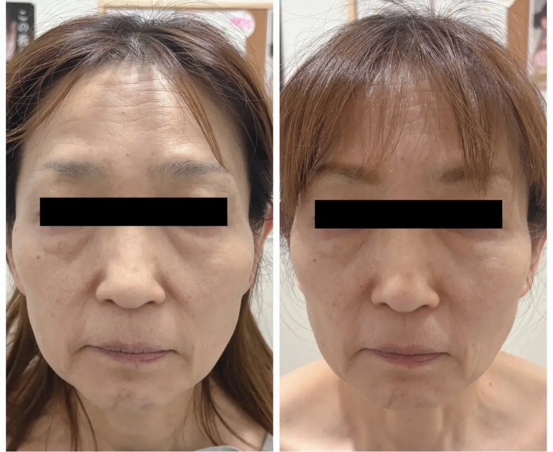 esthetic salon Ranのその他イメージ