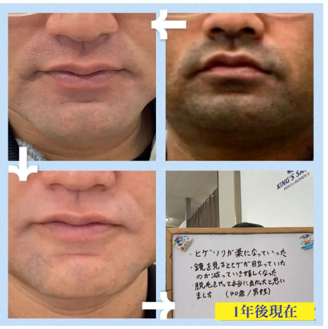 メンズ キングスサロン 長崎佐世保店のエステ・リラクイメージ