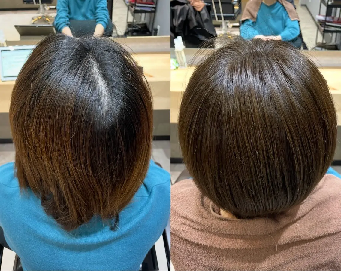 ⭐️生えぐせ改善 ヘアリセッター✂️のヘアスタイル