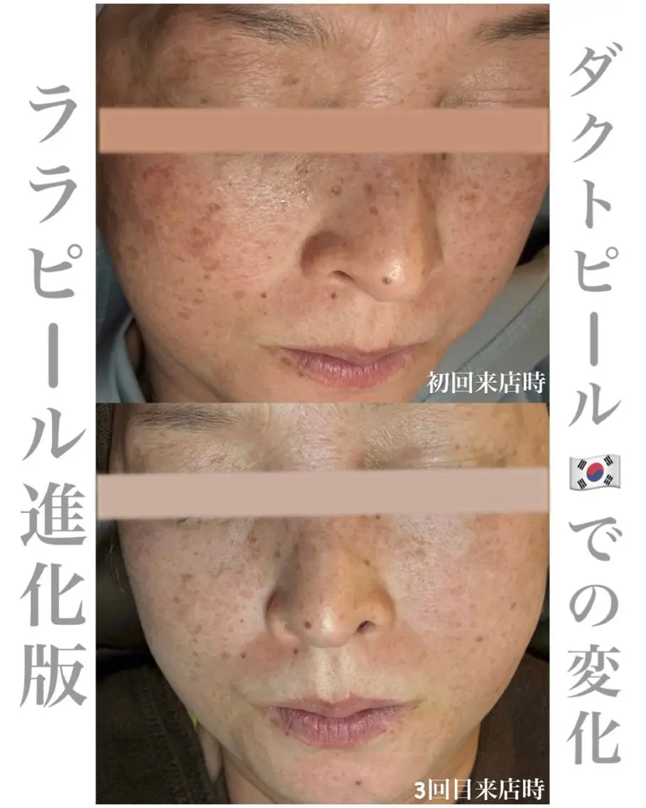 その他 トータルボディケア chouchouのその他イメージ