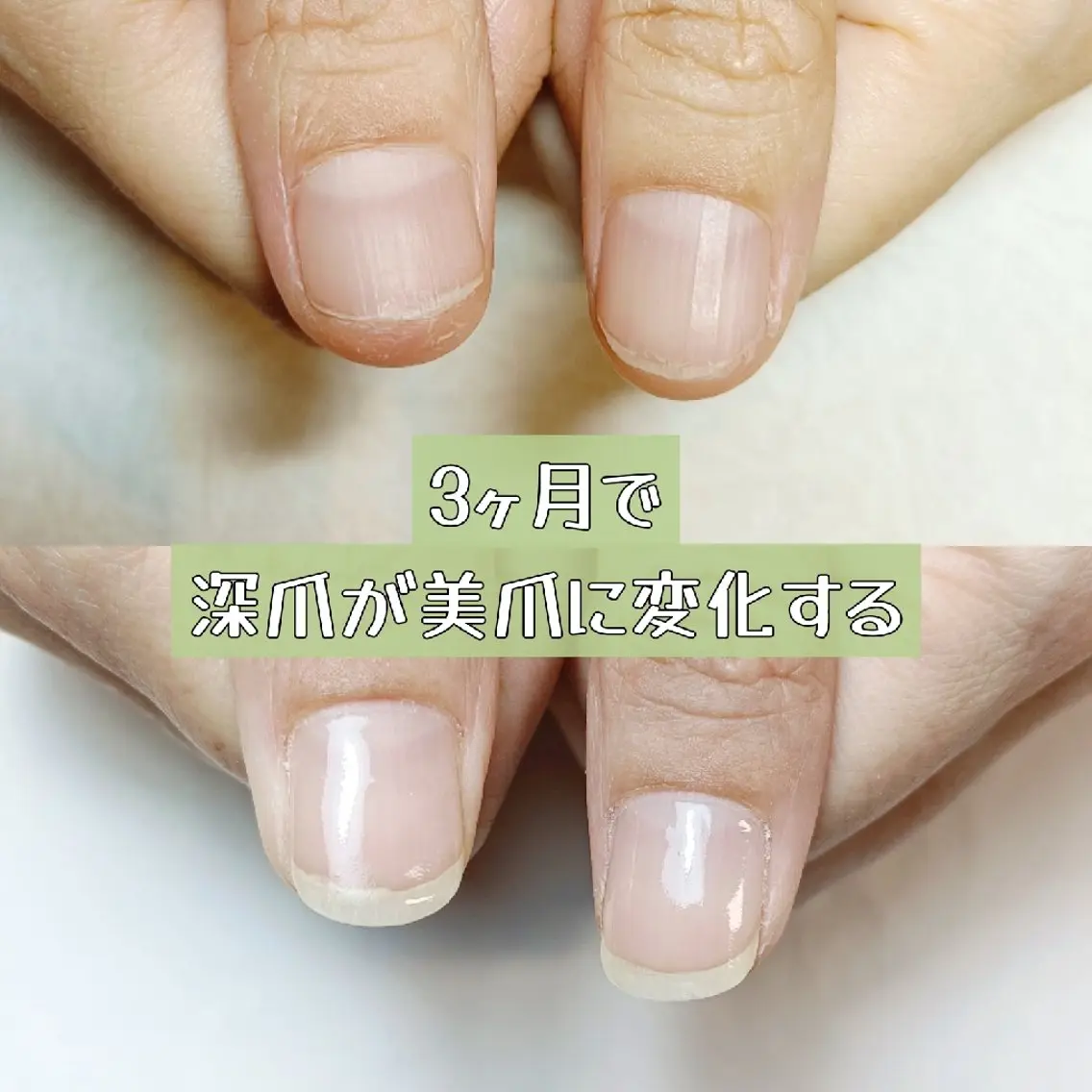 ネイル ハンドネイル ハンドケア 深爪矯正/爪育成ケア manie nailのネイルデザイン