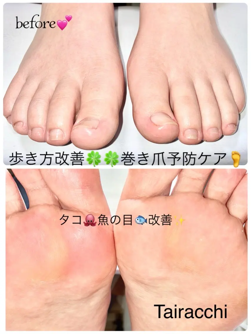 ネイル フットネイル フットネイル Tairacchi ﾀｲﾗｯﾁのエステ・リラクイメージ