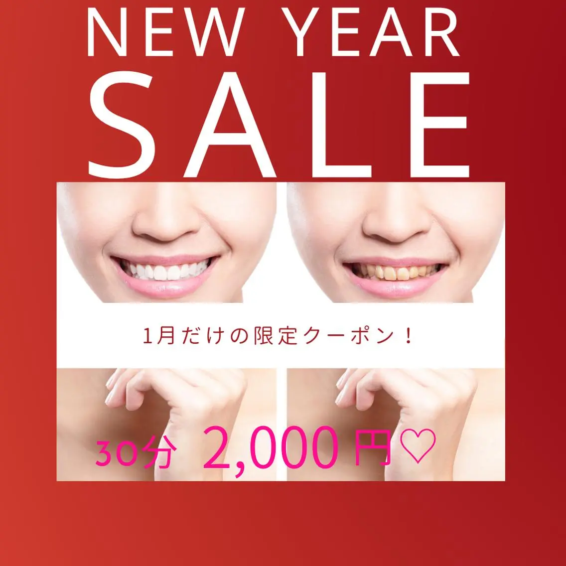 エステ リラク ロイヤルラウンジ ホワイトニング渋谷のその他イメージ