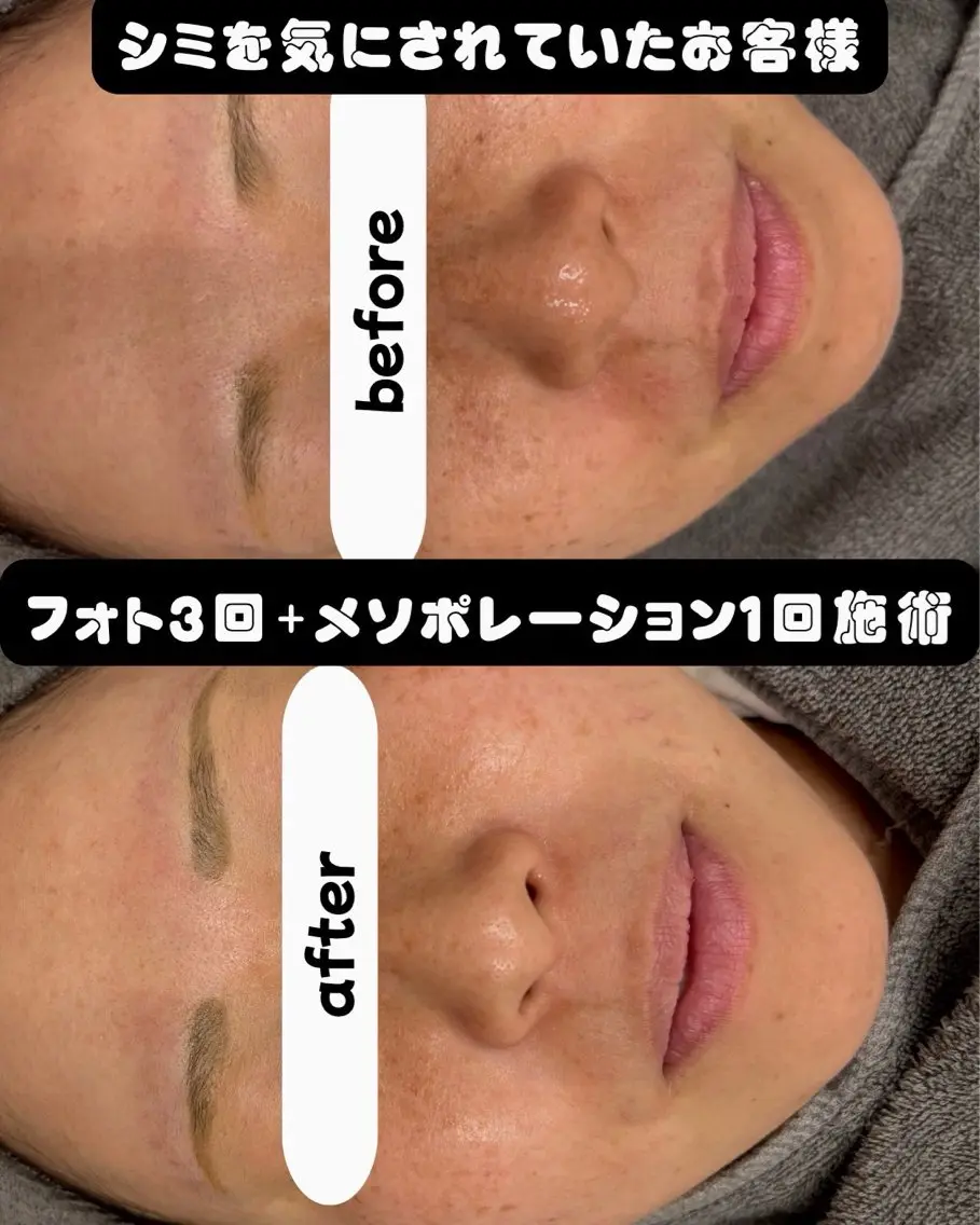 エステ シミケア専門サロン LICCO’S岡崎のエステ・リラクイメージ