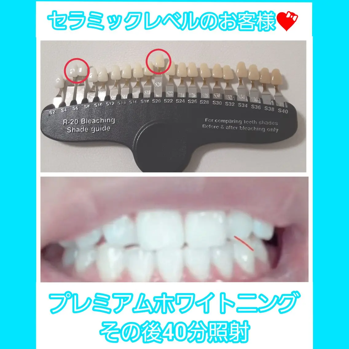 その他 五十嵐 蓮のその他イメージ