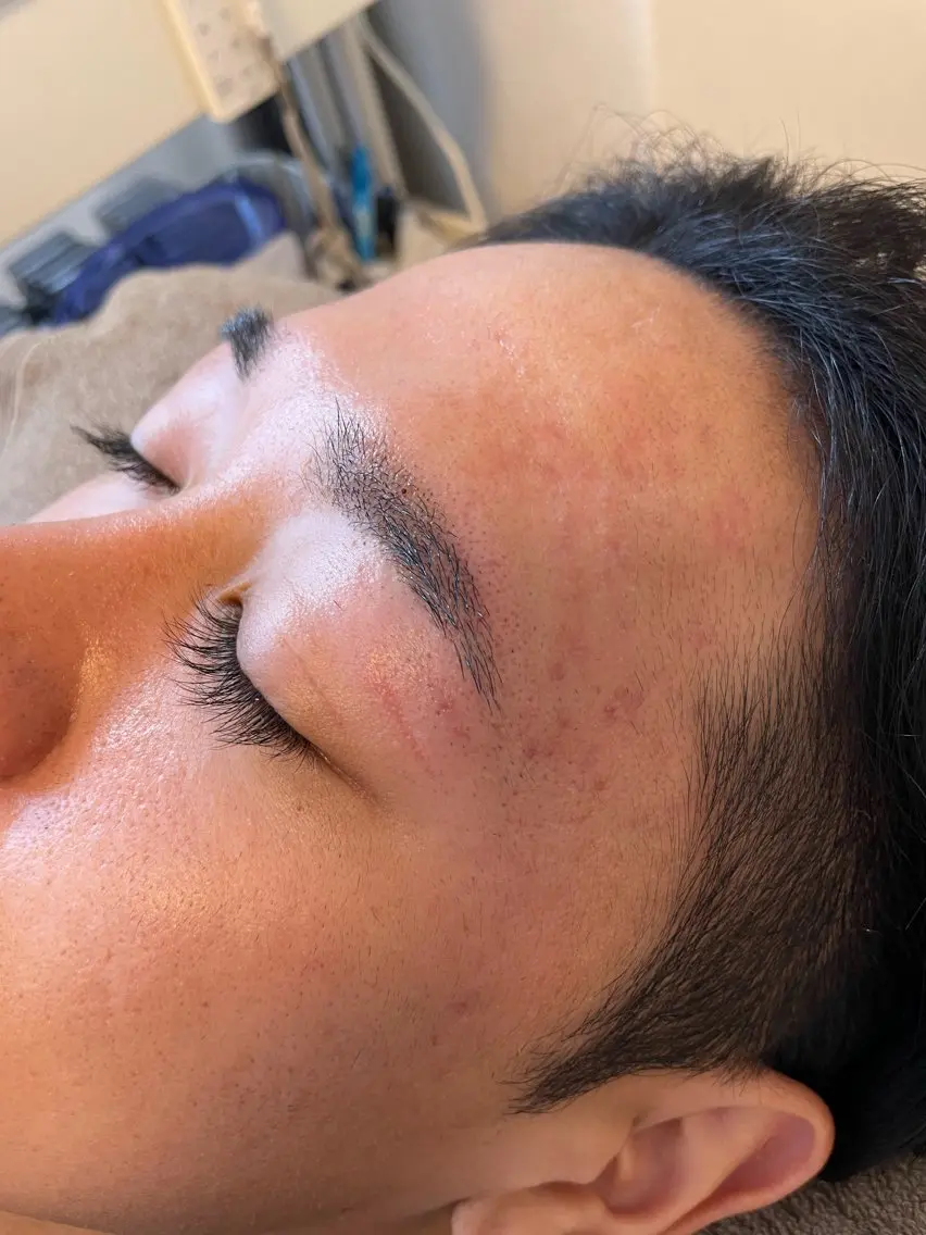アイブロウ ワックス脱毛 その他(アイブロウ) R ...Rの眉毛・アイブロウイメージ