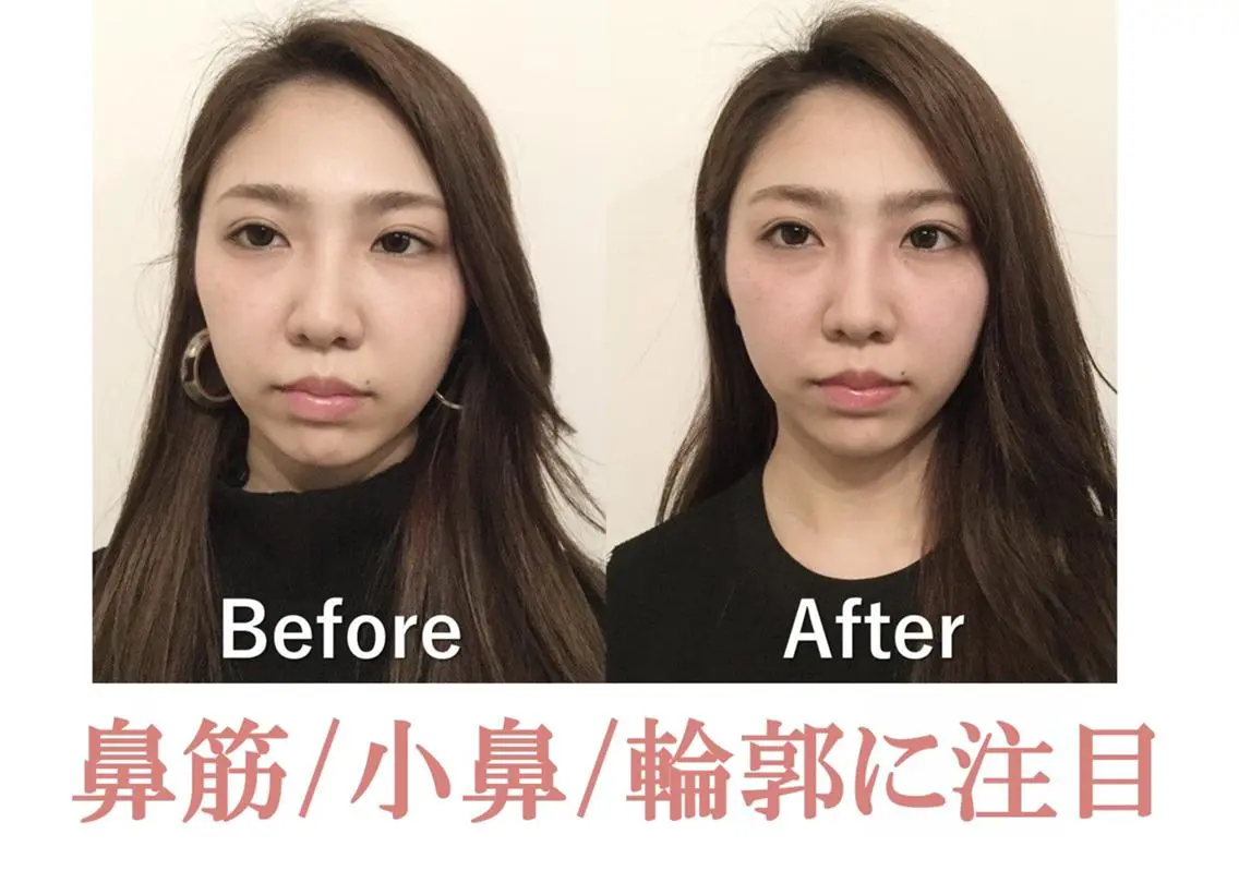 美鼻&小顔専門店 ラプリ　川村のエステ・リラクイメージ