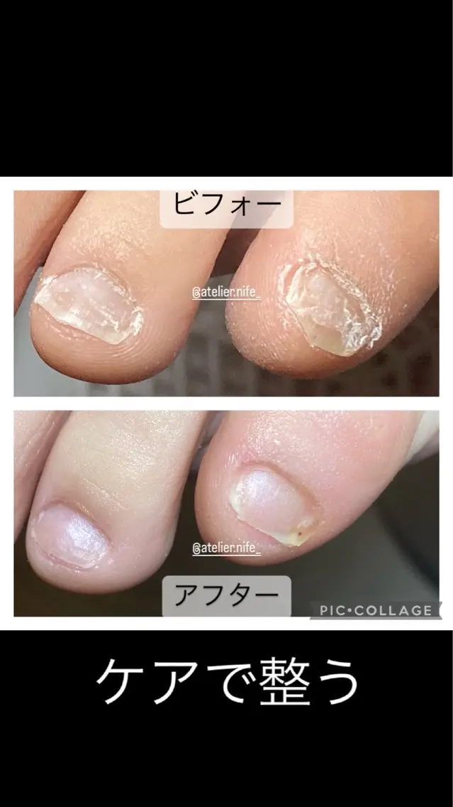 ネイル フットネイル atelier nife.のネイルデザイン