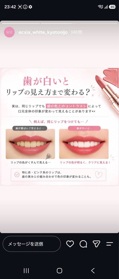 ホワイトニング 梨乃のその他イメージ
