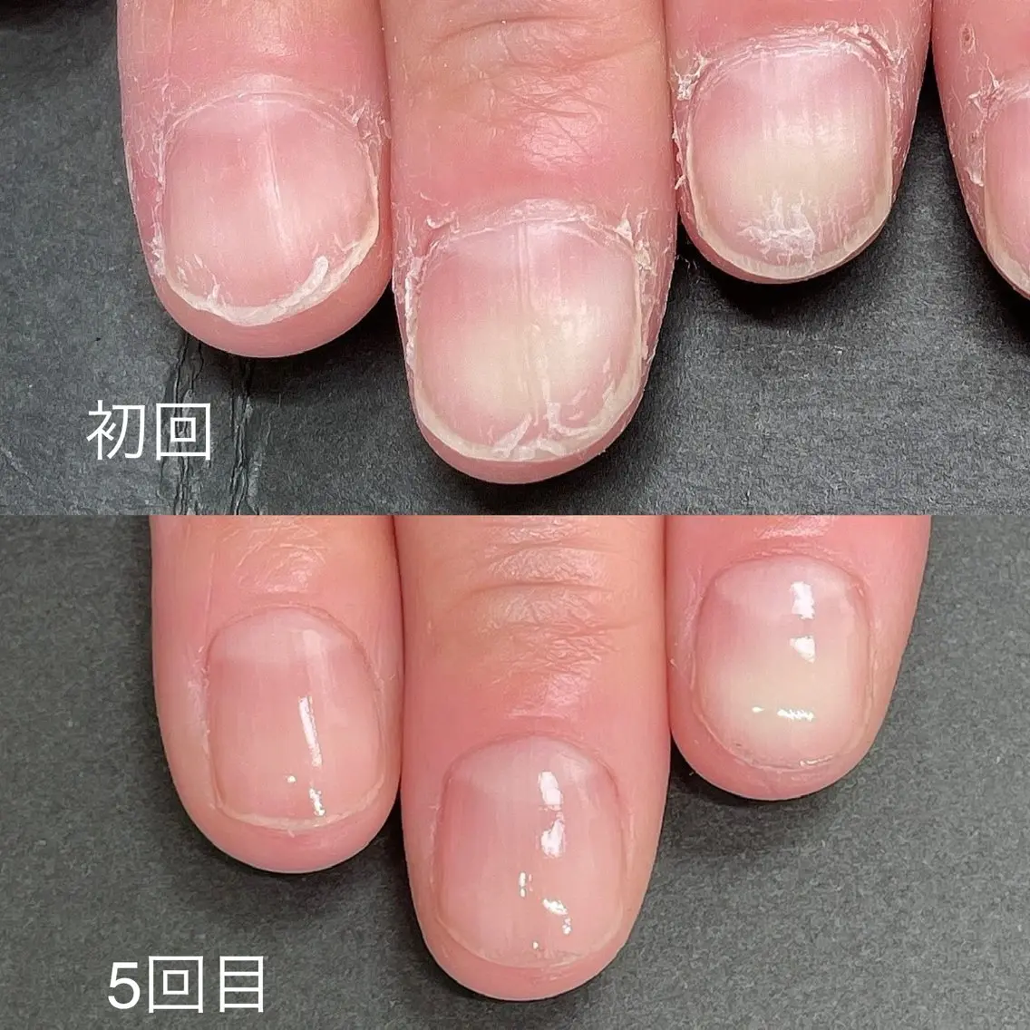 ネイル ハンドケア 関山 志乃のネイルデザイン