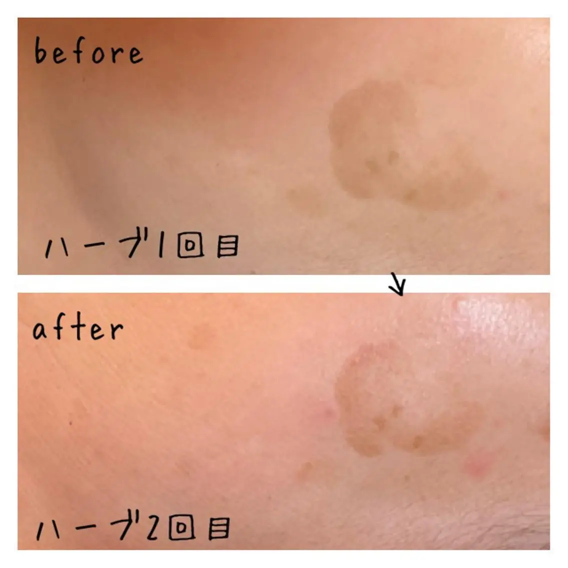 fairyrose organicエステのエステ・リラクイメージ