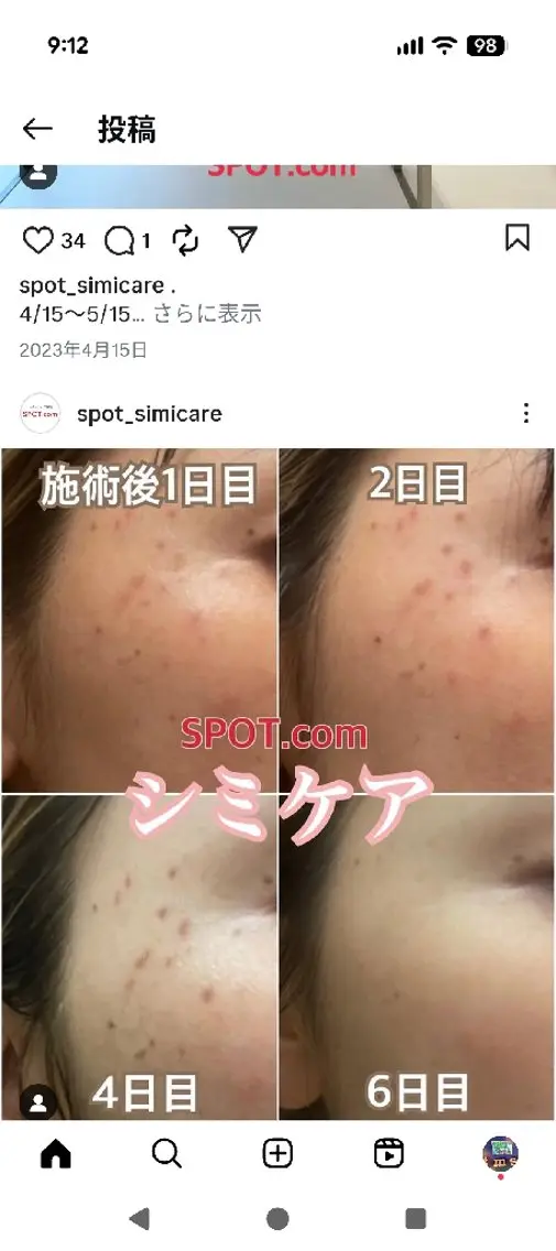 SPOT.com  シミケア専門店のエステ・リラクイメージ