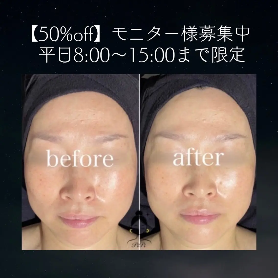集まり次第終了 | モニター様募集| 50%off |平日8:00〜15:00枠限定🌙小顔リンパマッサージの写真
