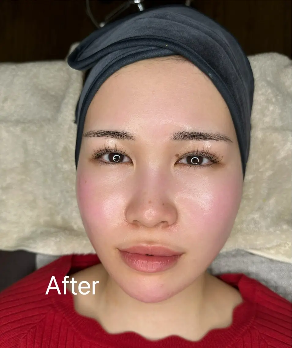 【ミニモ学割U24】🎓透明感UPフェイスワックスの写真
