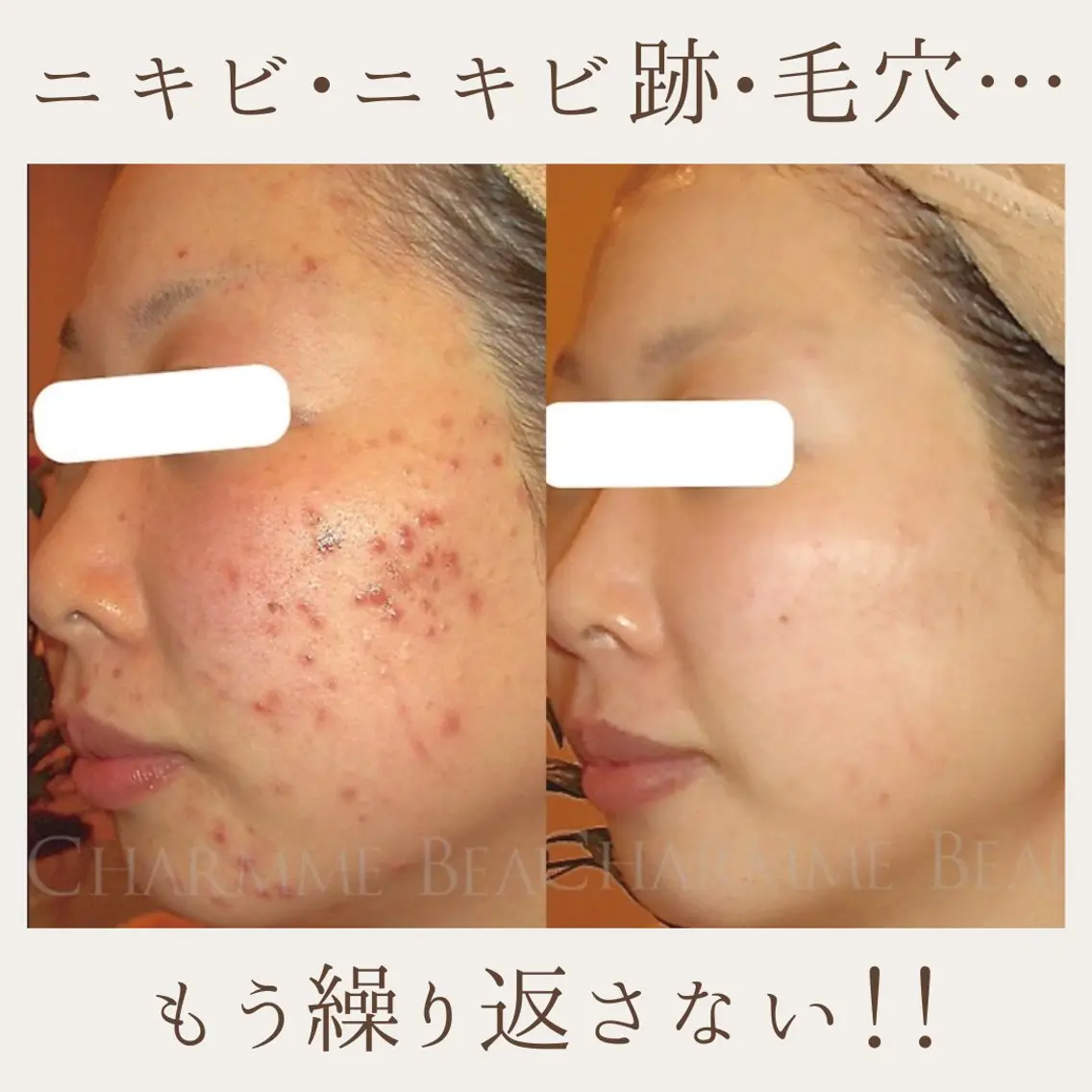 肌質改善サロン renew/ウエキのエステ・リラクイメージ