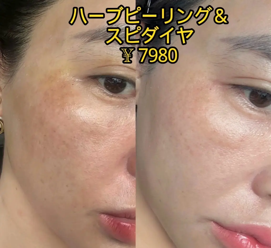 エステ JUNA 健康美サロン渋谷店のエステ・リラクイメージ