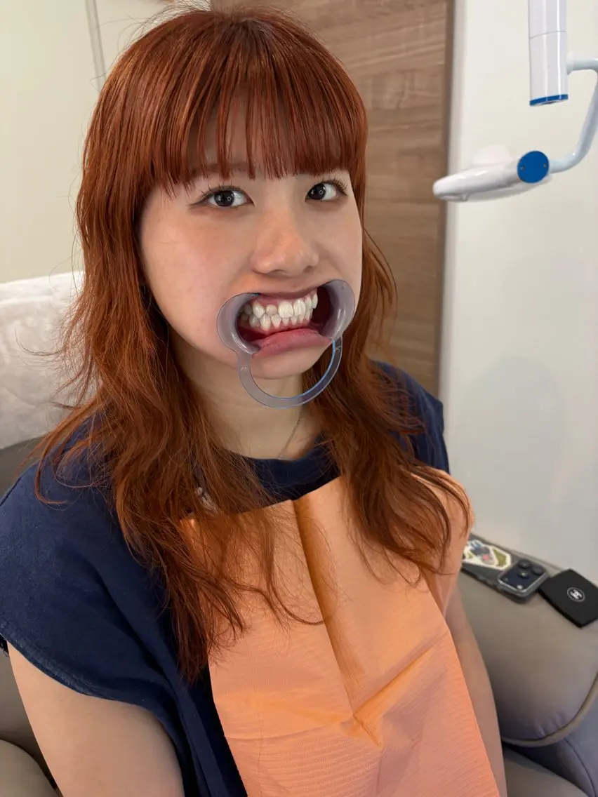 東区香椎歯のセルフホ ワイトニングGLOWのその他イメージ