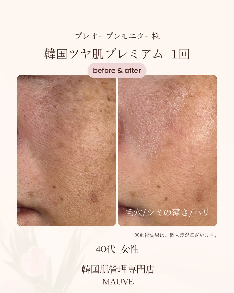 エステ MAUVE minamiのエステ・リラクイメージ