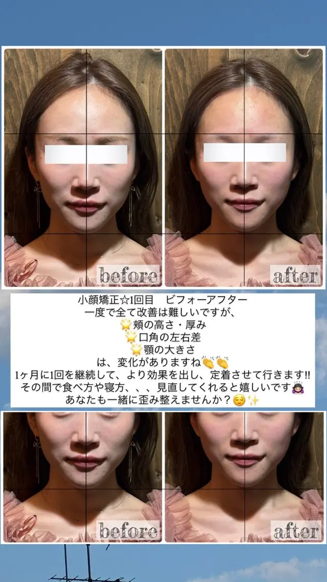 エステ リラク 💎後悔させない小顔 矯正💎イトヤマ🌱のエステ・リラクイメージ