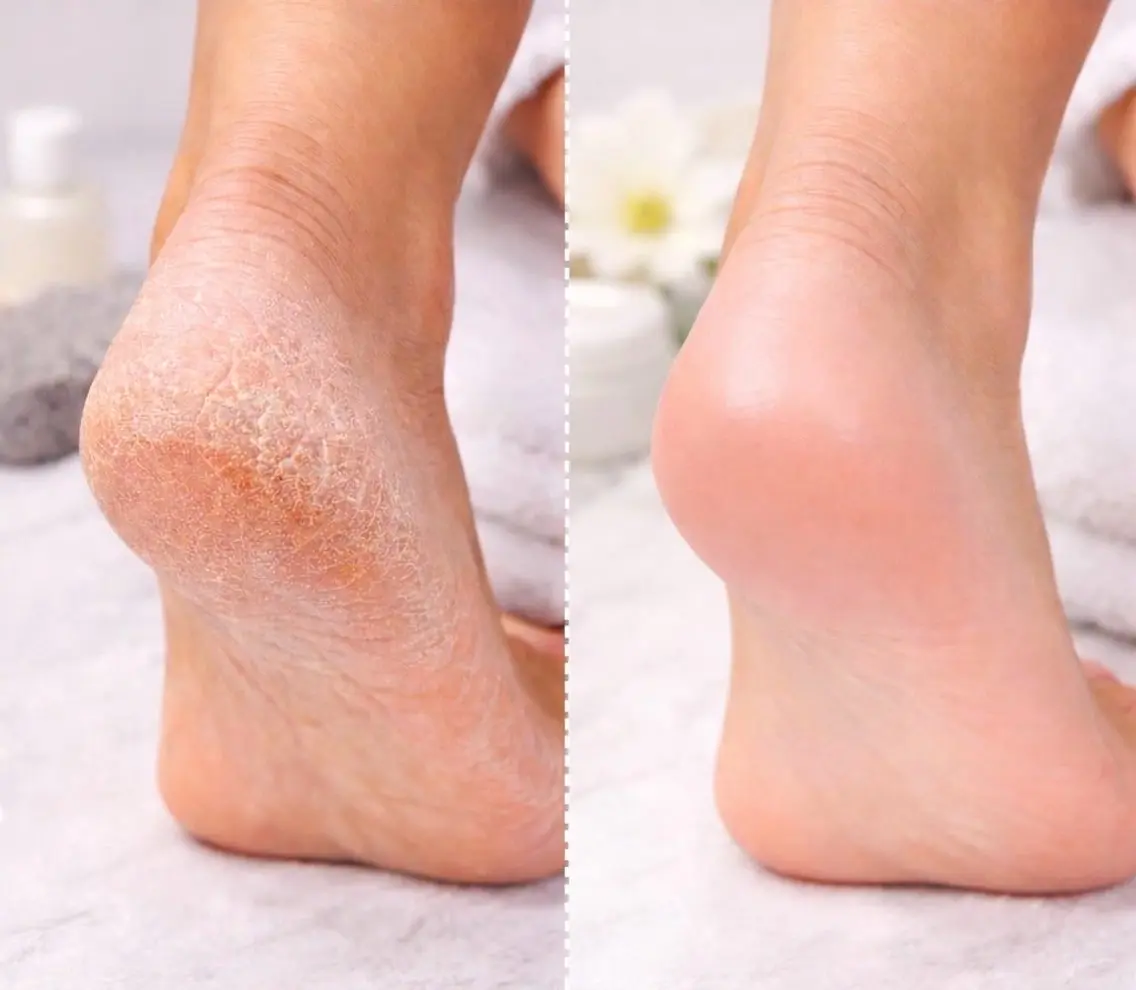 【ミニモ限定💅✨️】【映え足SET】フットワンカラー＋角質除去＋バス付★隙なし美人コースの写真