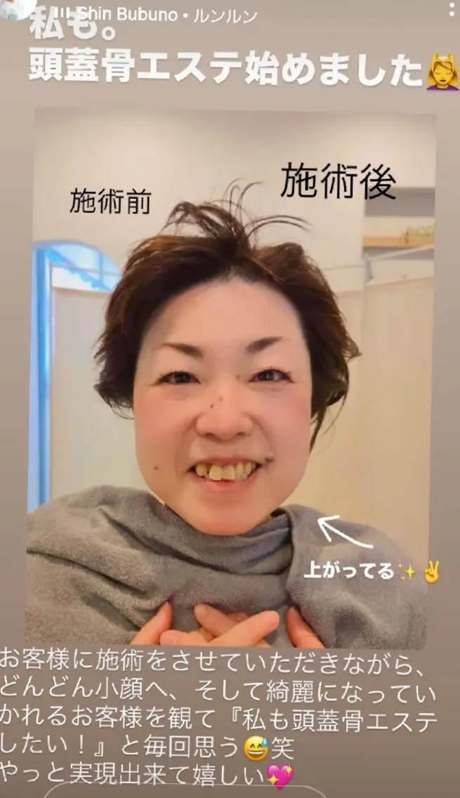 Rian 式頭蓋骨エステ40分の写真