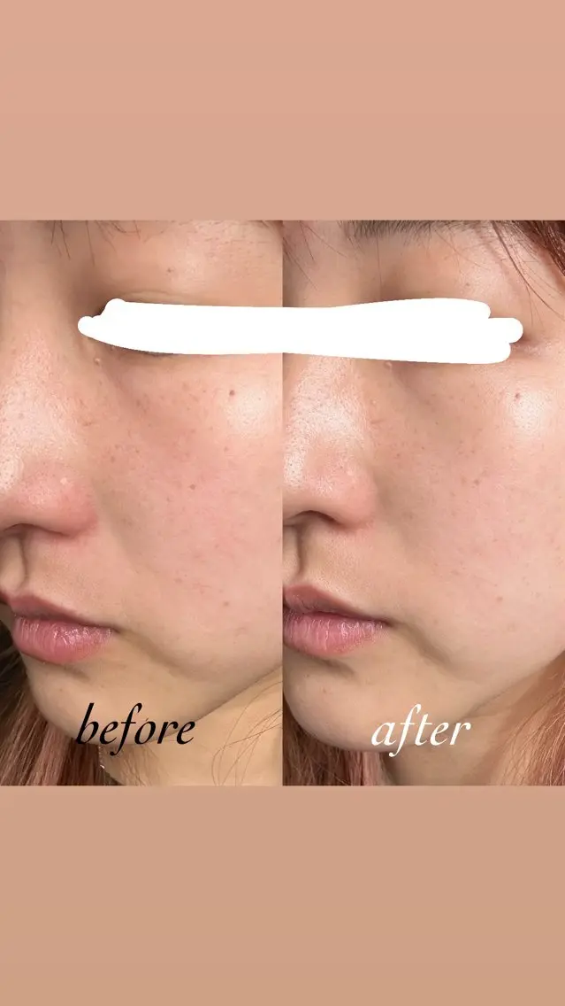 エステ pllia beautyのネイルデザイン