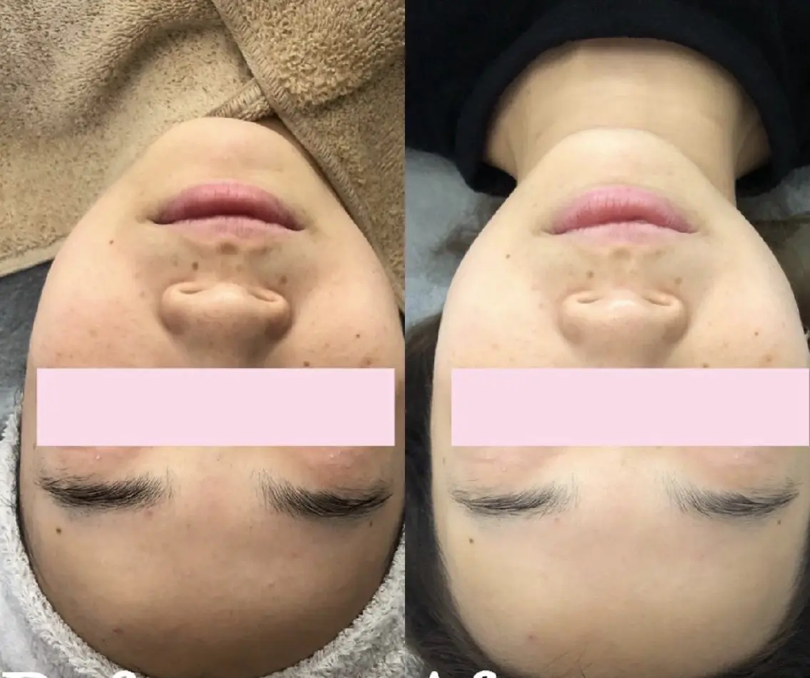 マツエク・マツパ エステ 愛維美水光専門店 川崎彩鳳のエステ・リラクイメージ
