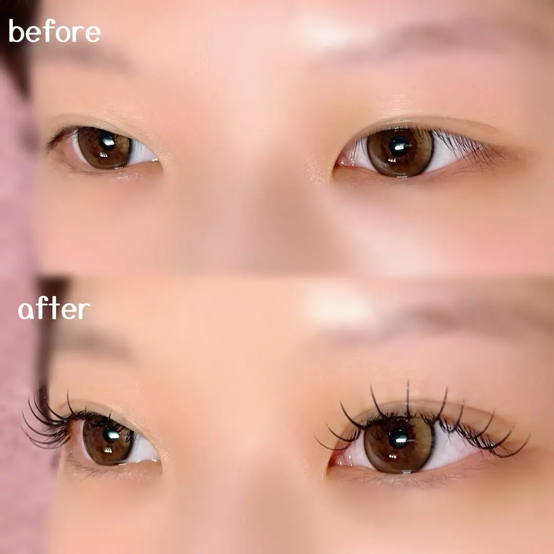 フラットラッシュ 100本の写真