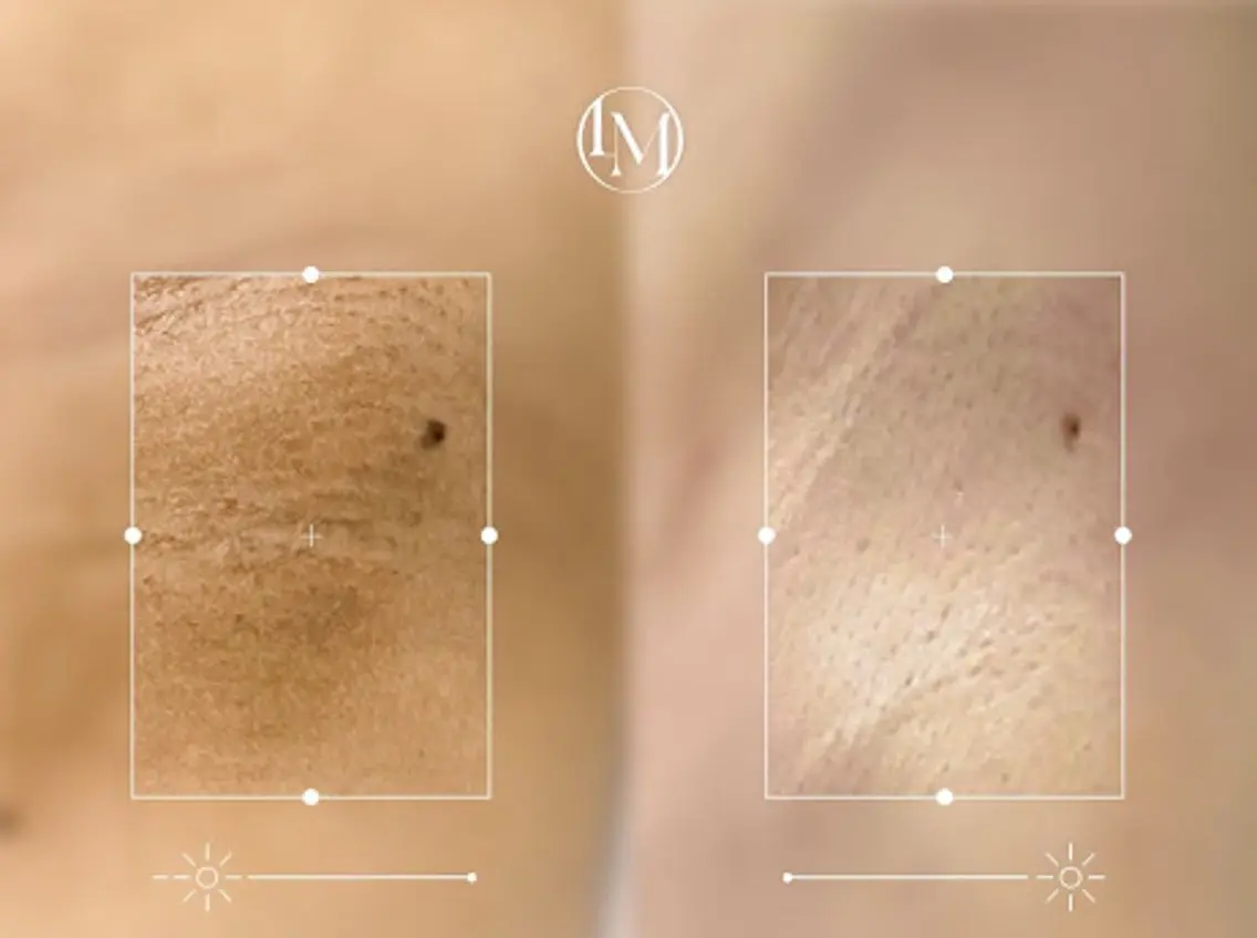 Momo beautyのその他イメージ
