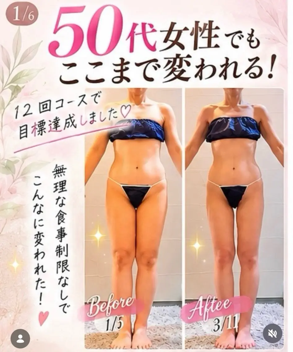 エステ 切らない脂肪吸引🔥 Neroliまりこのエステ・リラクイメージ