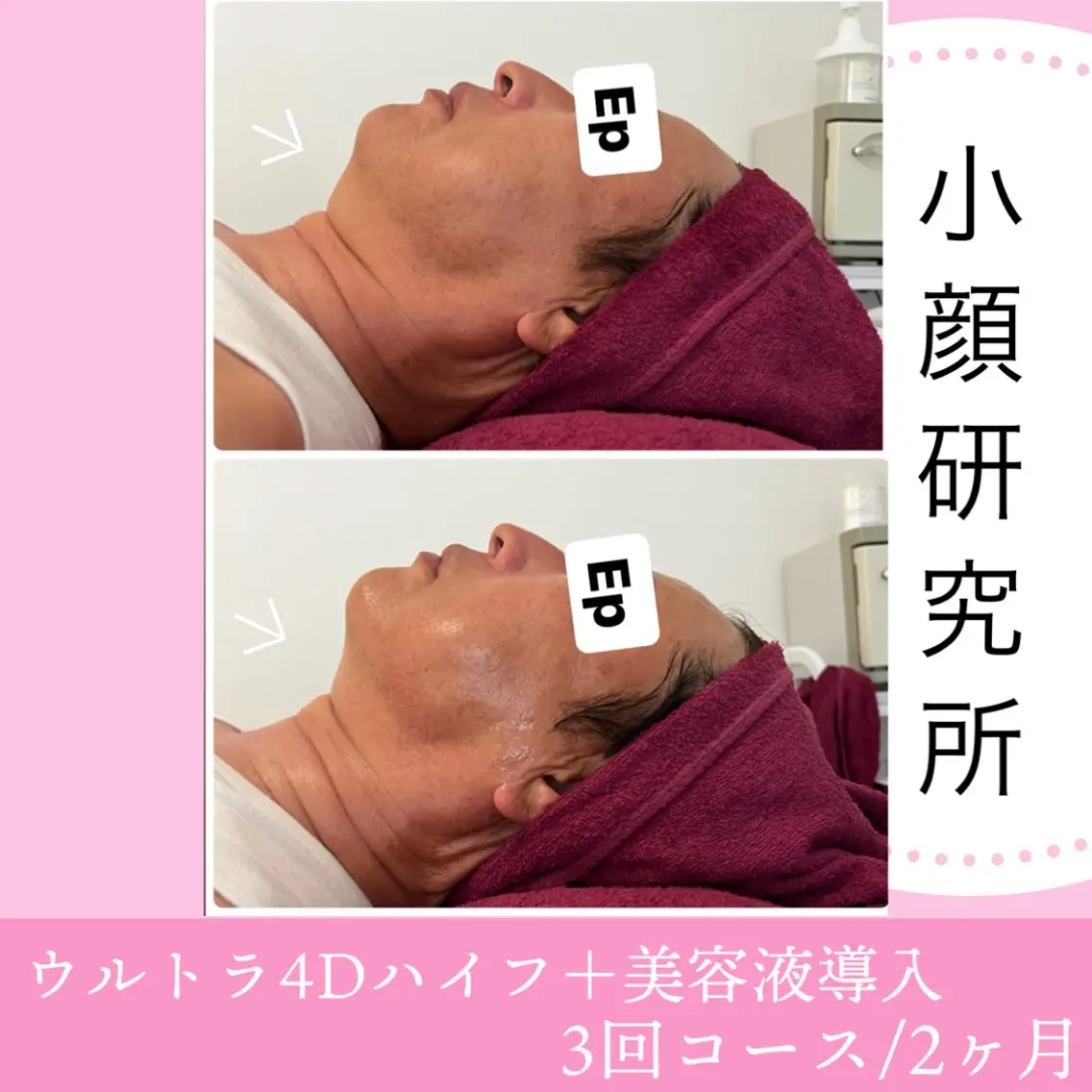 beauty salon epのエステ・リラクイメージ