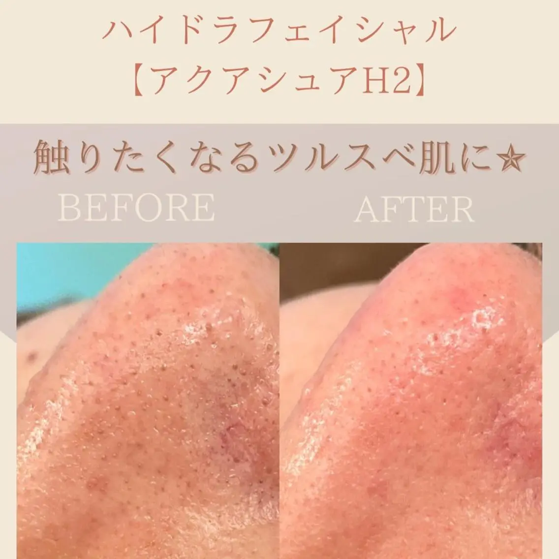 メンズ エステ 小顔・美肌 ルミエールのエステ・リラクイメージ