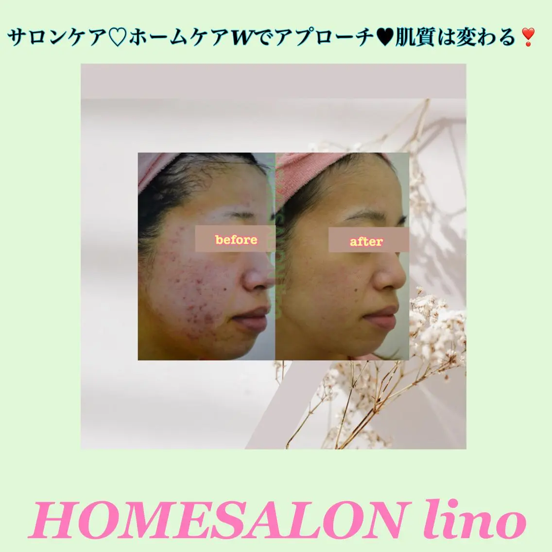 エステ HOME SALON linoのエステ・リラクイメージ