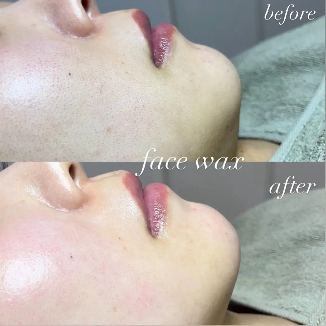 脱毛 beauty salonWのエステ・リラクイメージ