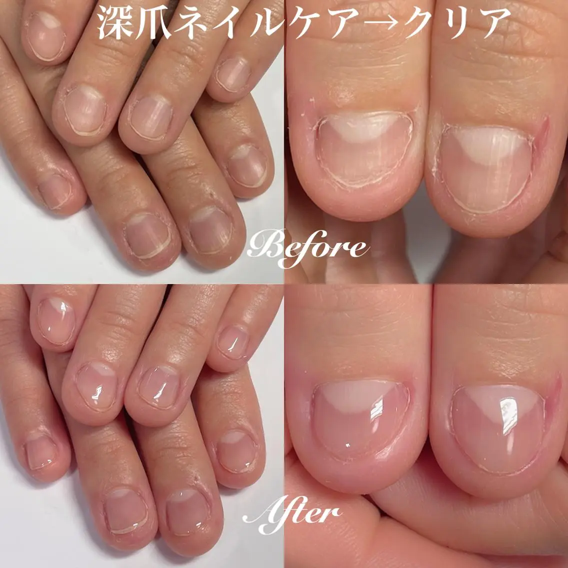 ネイル クリアネイル ジェルネイル .Nails Mio 赤羽西ネイルサロンのネイルデザイン
