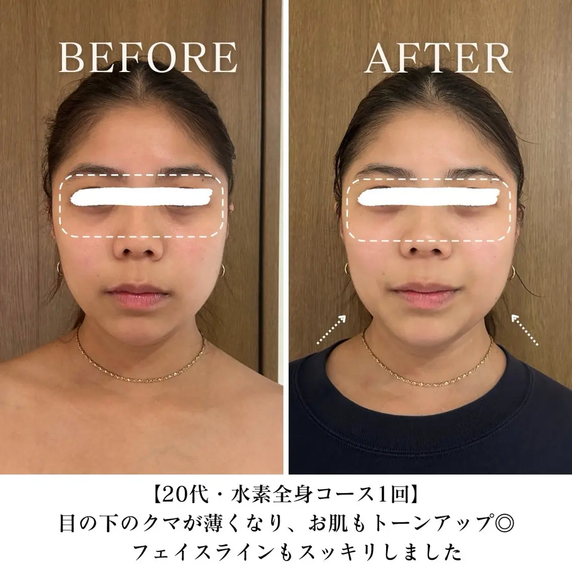エステ リラク 【目黒】本格痩身✴︎ 最新型よもぎ蒸しのエステ・リラクイメージ