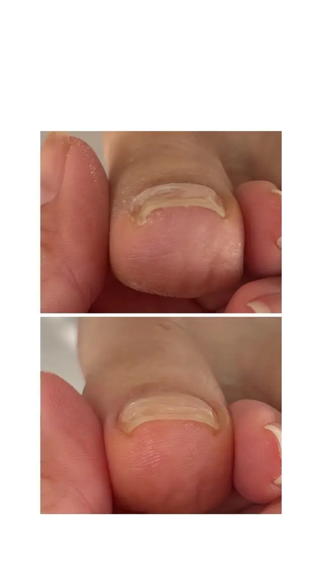 ネイル Alo.nail アロ•ネイルのネイルデザイン