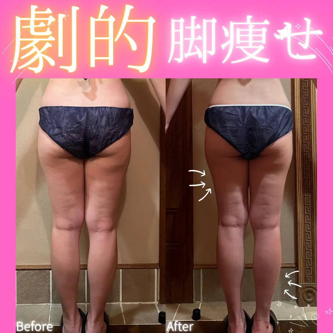 その他 痩身&美肌サロン 堀米✨のその他イメージ