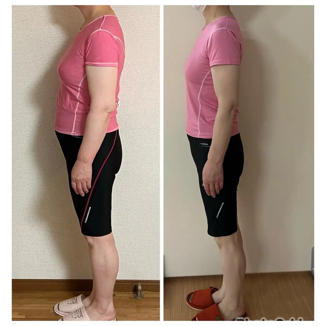 美人スイッチdiet スーパージェクションのその他イメージ